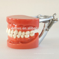 Manufacturer Directly Sale Practice Dental Model with Wax Fixed Screw Teeth 13007